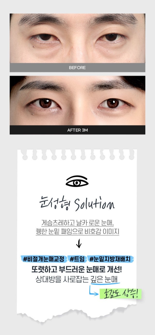 무엇이든물어보살 홍민기 수술전후 관련 이미지 5