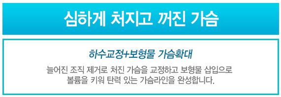 디에이 엄마를 부탁해 1. 가슴솔루션 관련 이미지 7