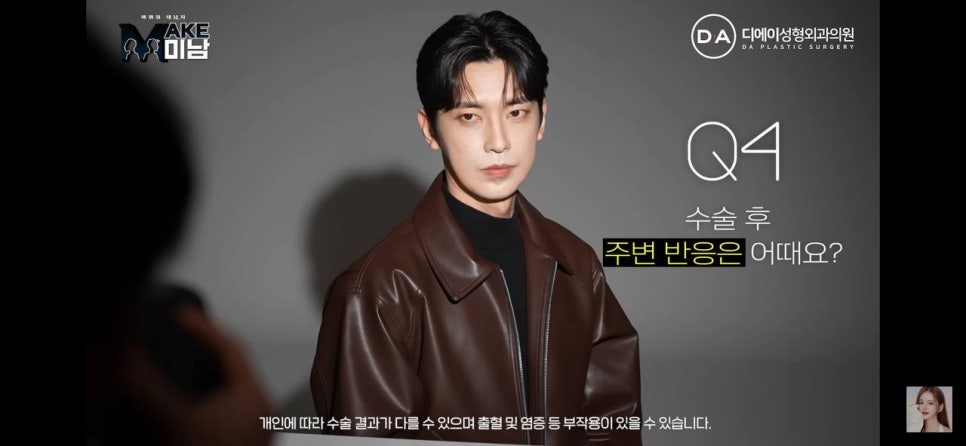 디에이성형외과 | 맥미남 시한폭탄내남자 개인인터뷰 근황 느낀점 관련 이미지 56