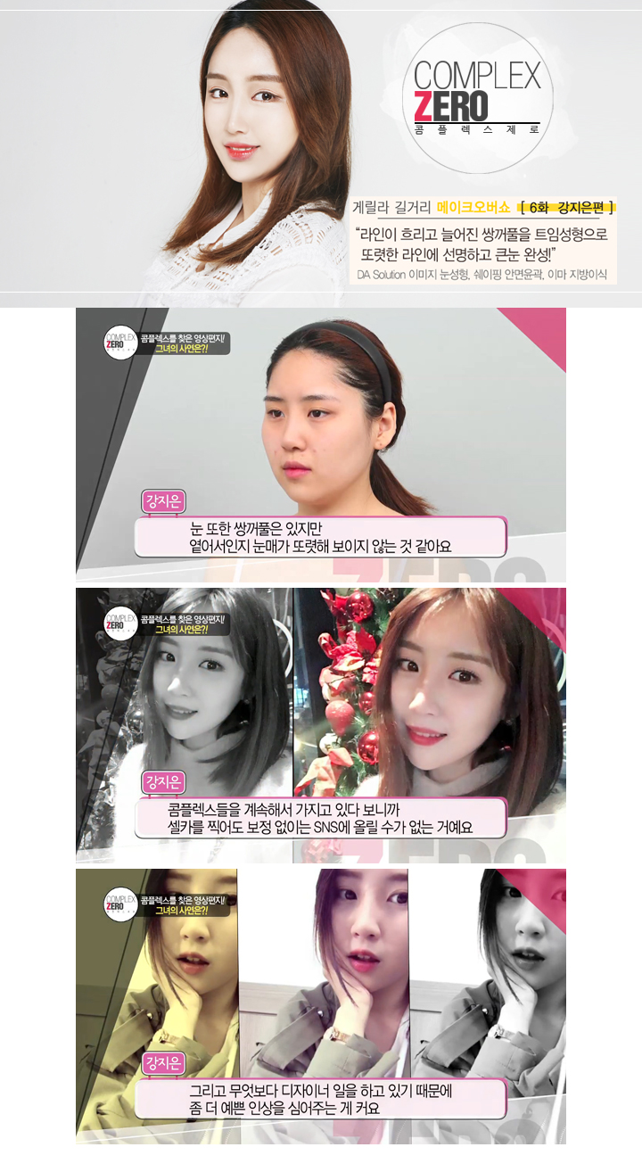 콤플렉스제로 트임성형 끝판왕 강지은 관련 이미지 3