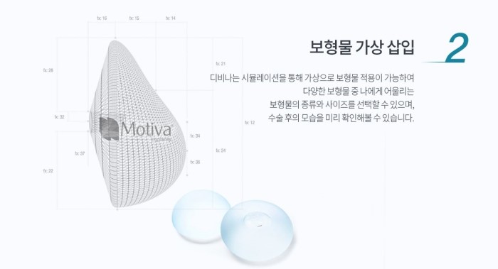 디에이성형외과 디비나 3D 입체 스캐너 도입으로 가슴성형 만족도 UP 관련 이미지 7