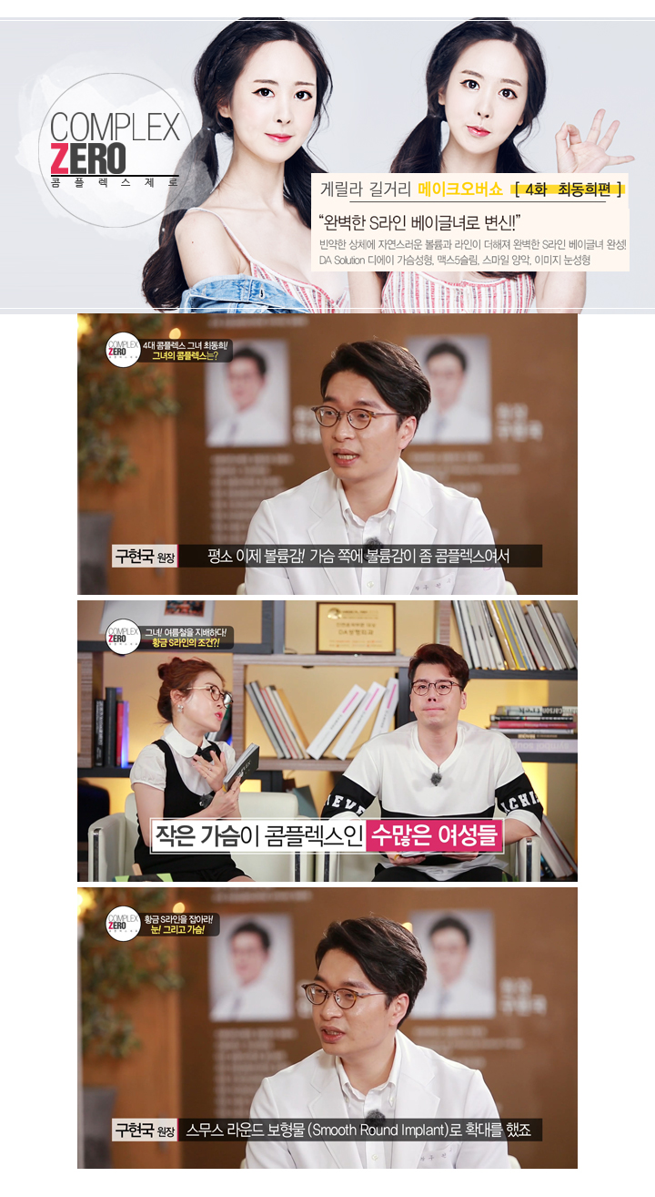 디에이성형외과 콤플렉스제로 S라인 베이글녀 최동희 관련 이미지 5