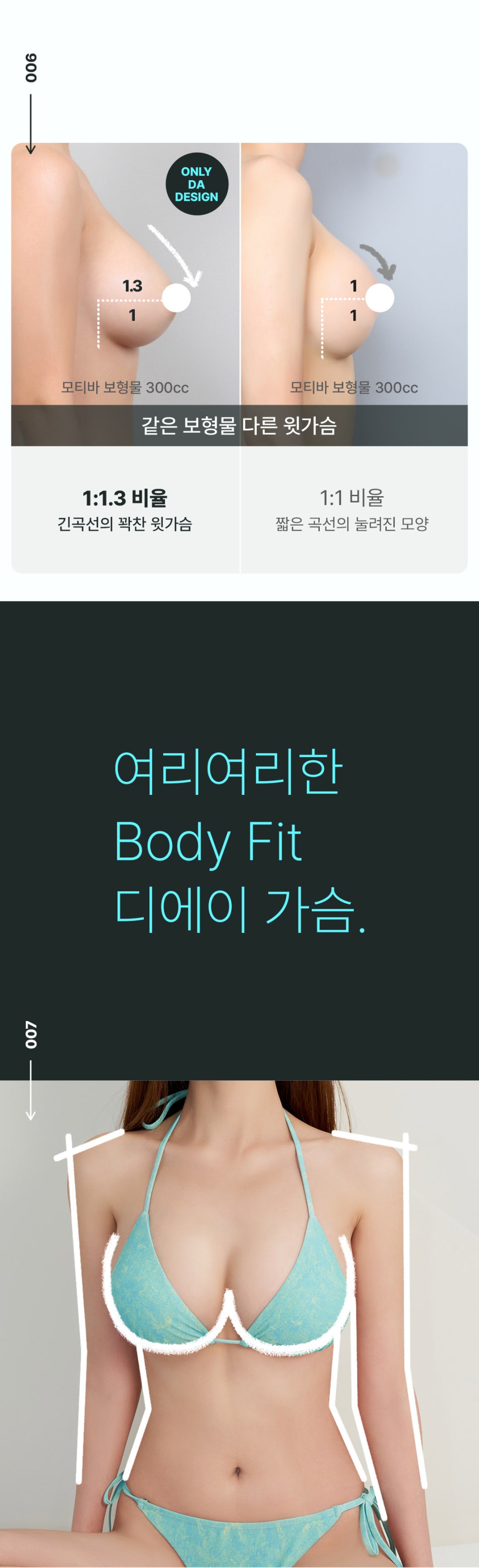 여리여리몸매 가슴성형 알아본다면 관련 이미지 5