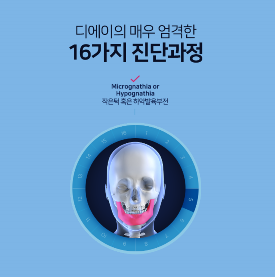 디에이성형외과 안면윤곽, 기본에 집중합니다 관련 이미지 6