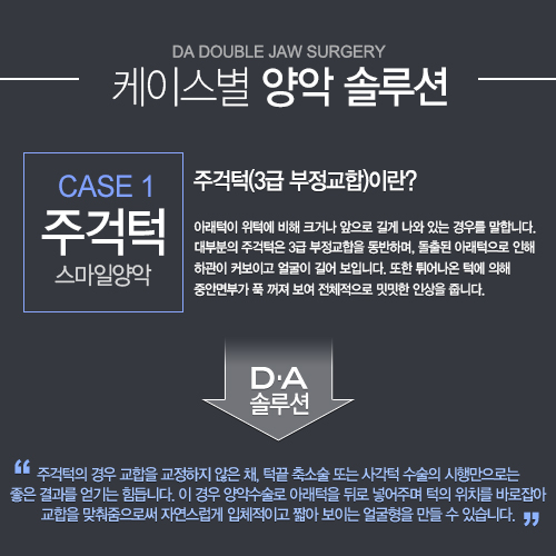 [DA성형외과 스마일양악수술]케이스별 양악솔루션을 소개합니다. 관련 이미지 1