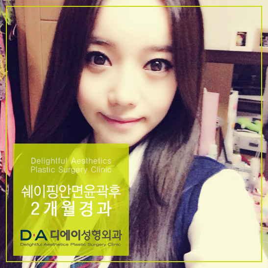 DA성형외과 쉐이핑안면윤곽수술로 매끈한 턱라인 완성! 관련 이미지 1