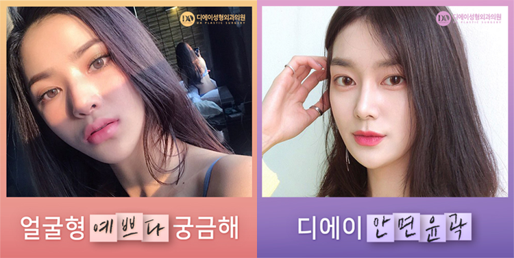 디에이성형외과, 윤곽3종으로 예쁨 UP 관련 이미지 4