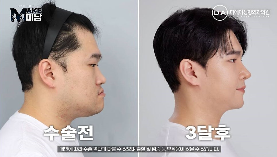 화요일추천예능 MAKE미남 맥미남 메이크미남 - 7화 야수내남자 인터뷰 관련 이미지 84