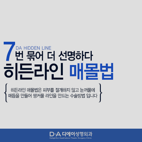 오직 남자만을 위한 DA성형외과 히든라인 눈성형 매몰법. 관련 이미지 1