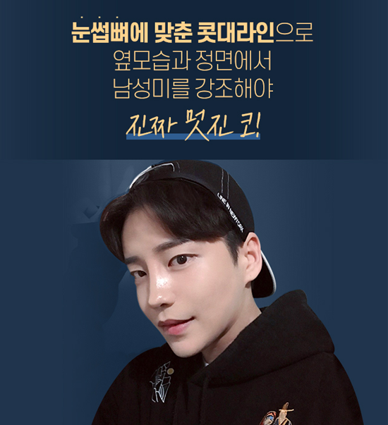 DA FOR MAN, 디에이성형외과 남자 코성형 관련 이미지 3