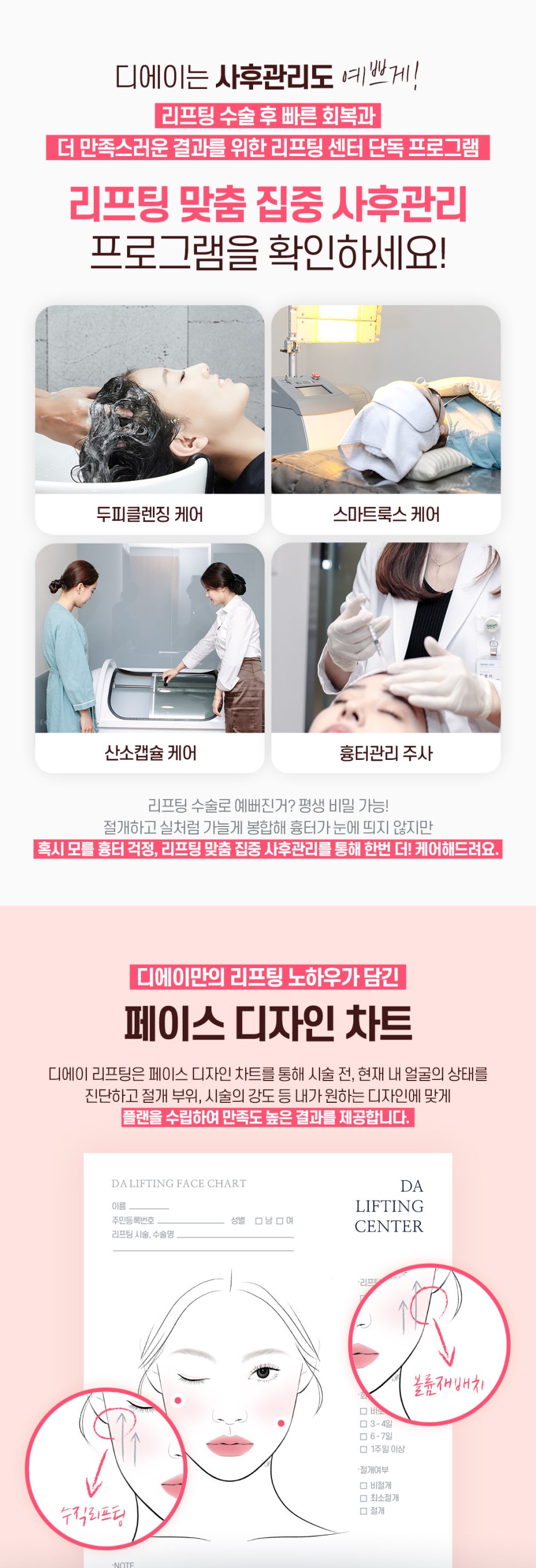 수직미니리프팅 수술법 가격 효과 알아보자면 관련 이미지 7