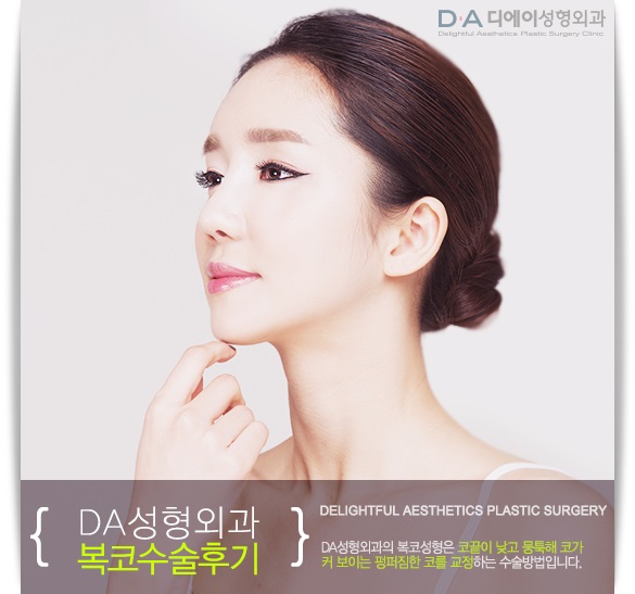 펑퍼짐한 코의 변신 DA성형외과에서 복코수술로 해결해요 관련 이미지 1