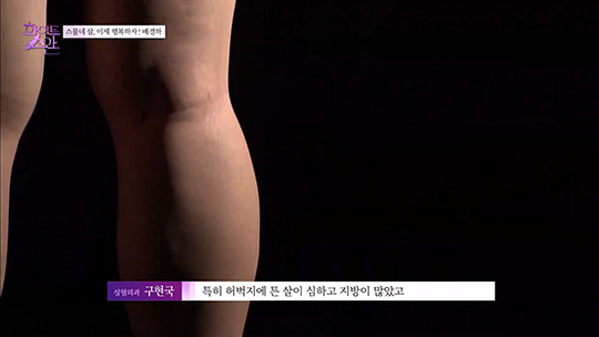 [DA성형외과] 화이트스완 5회 메이크오버 주인공 배경하 관련 이미지 19