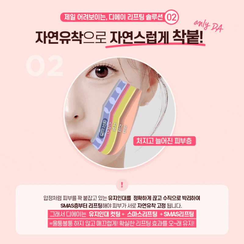 처진얼굴, 탄력개선에 효과적인 시술 방법 관련 이미지 7