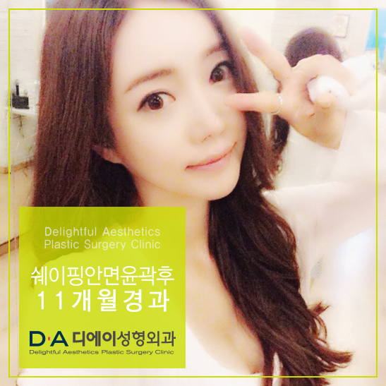 DA성형외과 쉐이핑안면윤곽수술로 매끈한 턱라인 완성! 관련 이미지 5