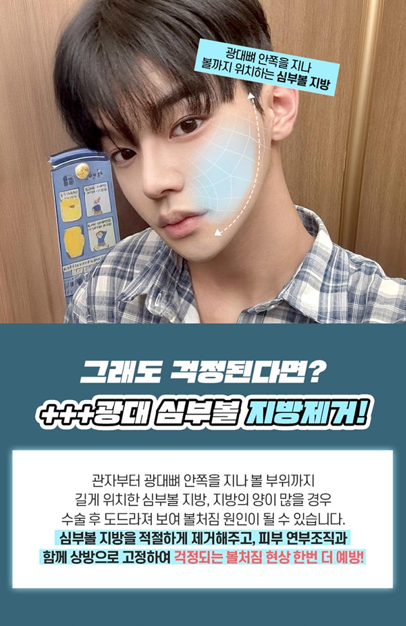 남자광대축소, 얼굴형과 옆광대 돌출을 함께 고려해야 하는 이유 관련 이미지 6