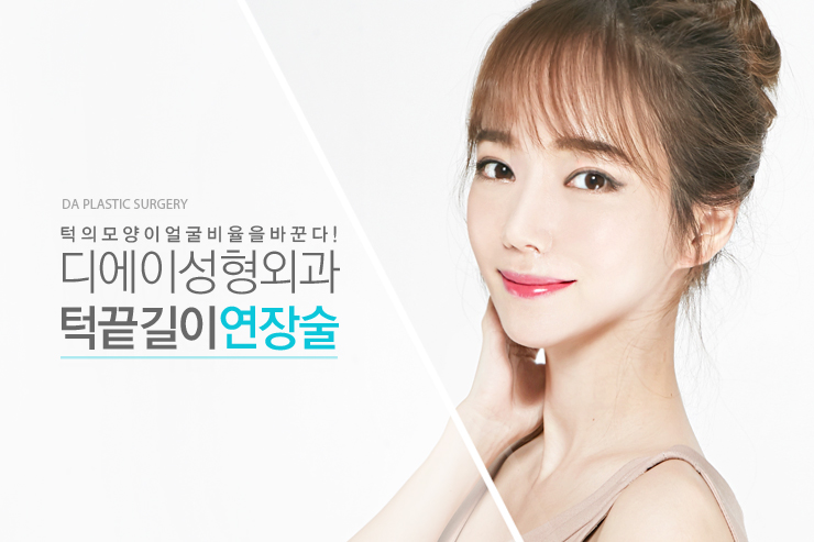 디에이성형외과 턱끝길이 연장술 관련 이미지 2