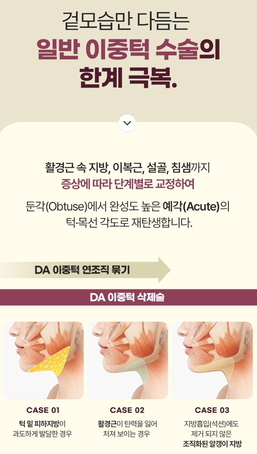 Double Chin Removal Surgery: Essential Information from Effects to Recovery Time image 4