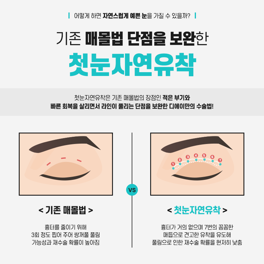 쌍꺼풀수술 후 풀림 현상을 예방하기 위해서는? 관련 이미지 4
