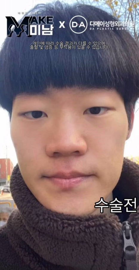 [맥미남] 소심이내남자 한 눈에 보는 외모변천사 관련 이미지 1