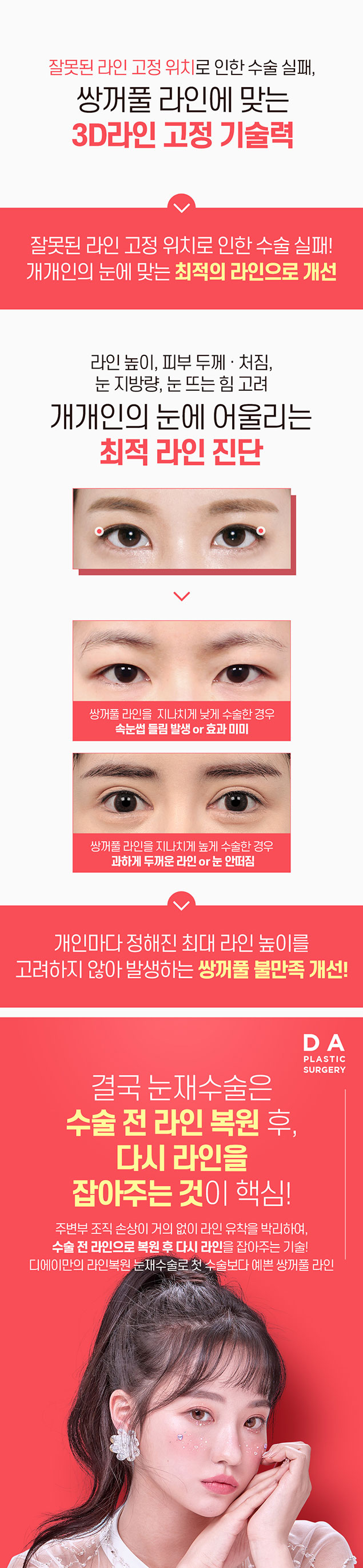 강남역 눈재수술 잘 하는 곳 관련 이미지 6