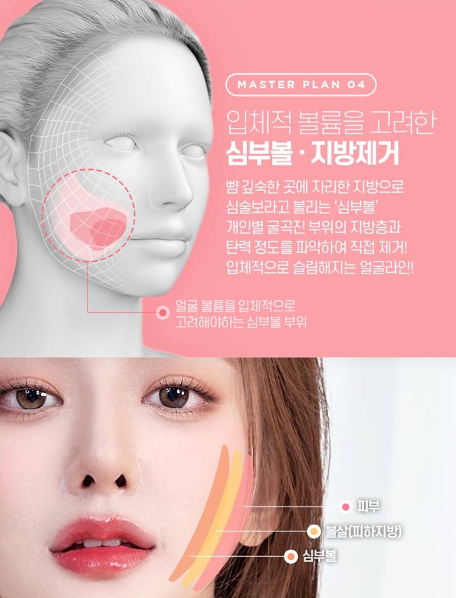 사각턱수술 비용보다 중요한 선택 기준은? 관련 이미지 6