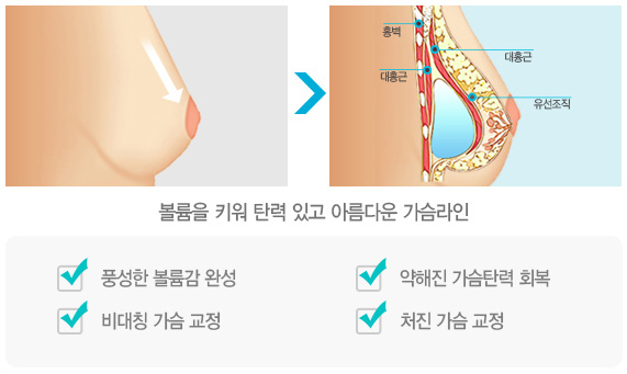 디에이 엄마를 부탁해 1. 가슴솔루션 관련 이미지 9