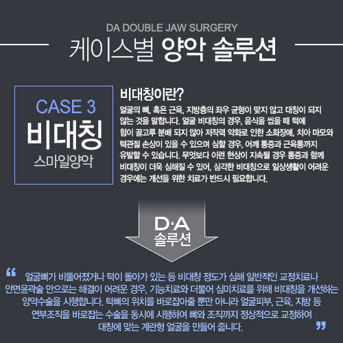 [DA성형외과 스마일양악수술]케이스별 양악솔루션을 소개합니다. 관련 이미지 3
