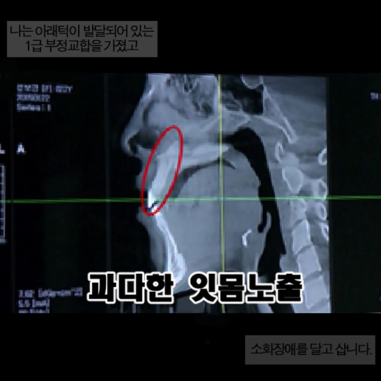 화이트스완 웹툰# 다시 꿈꾸고 싶은 외톨이, 설보경 관련 이미지 9