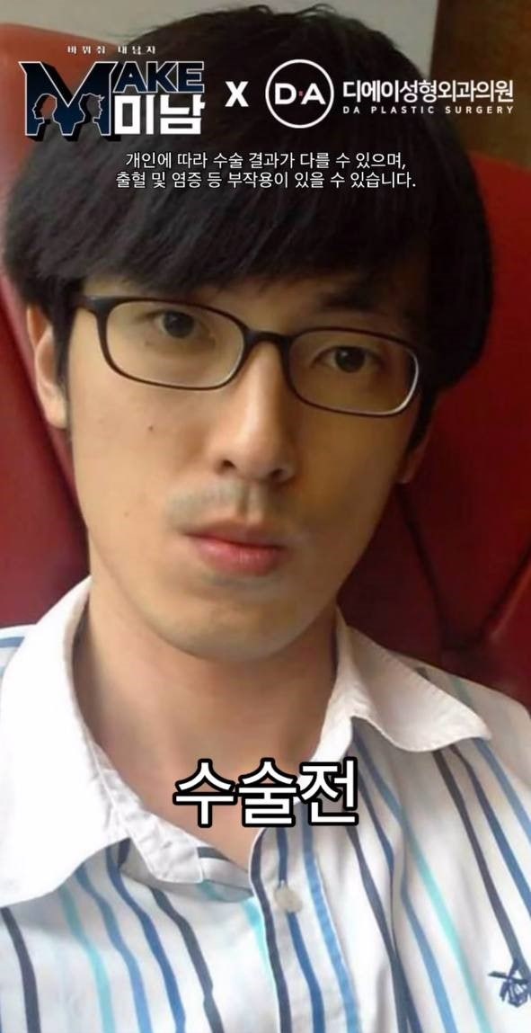 맥미남 무엇이든물어보살 성형남 홍민기 변천사 관련 이미지 3