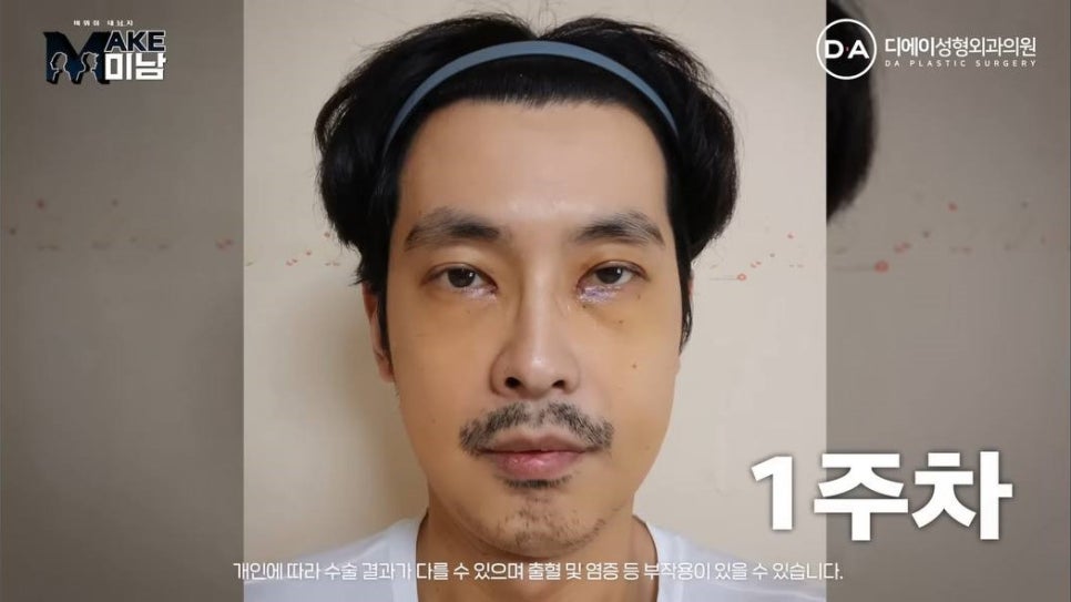 무엇이든물어보살 홍민기 성형 맥미남 후기 관련 이미지 6