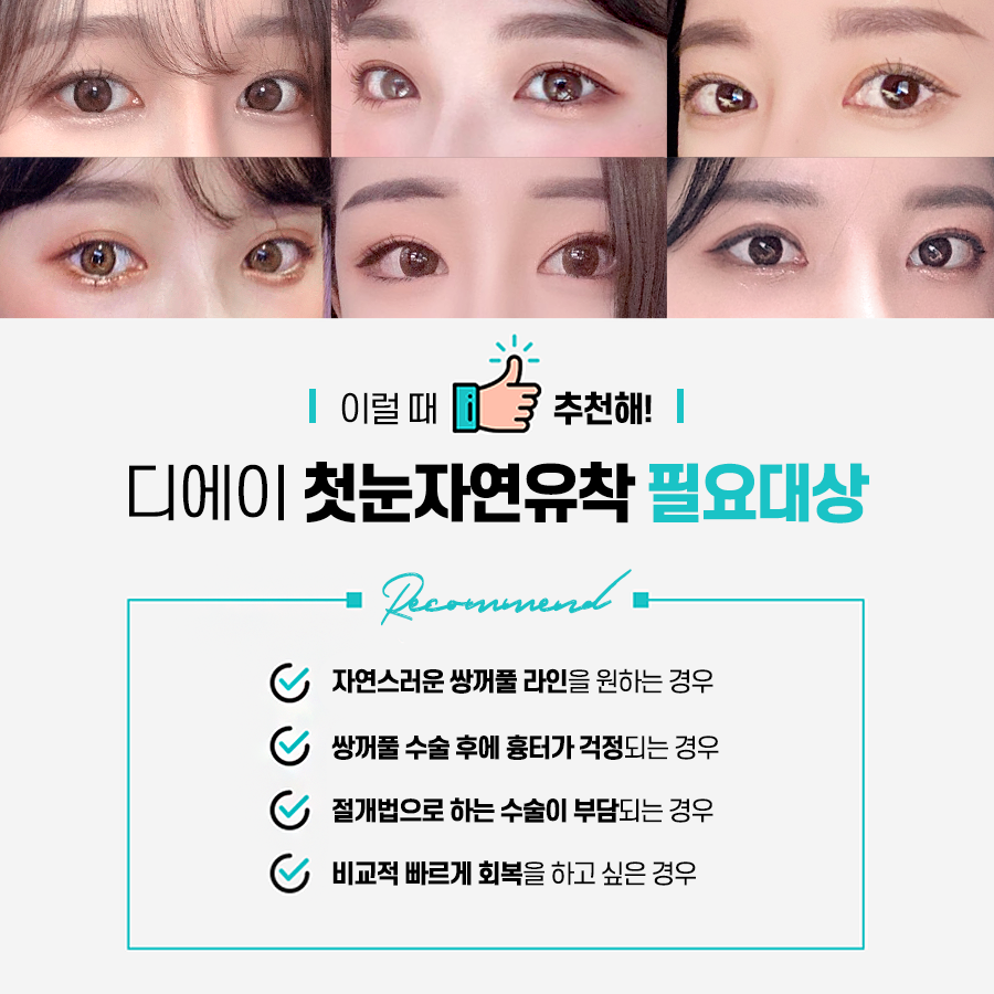 이미지에 맞게 라인 조절이 가능한 눈성형은? 관련 이미지 8