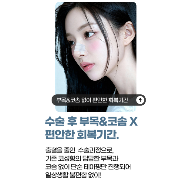 When You Want to Keep Your Image but Look Even Better: Closed Rhinoplasty Without Implants image 7