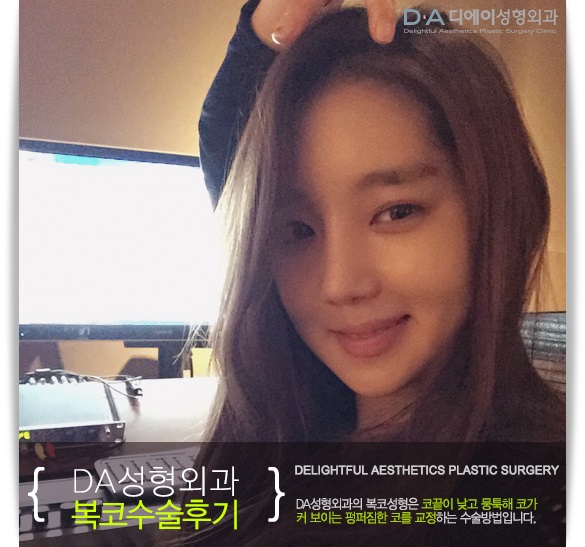 펑퍼짐한 코의 변신 DA성형외과에서 복코수술로 해결해요 관련 이미지 4
