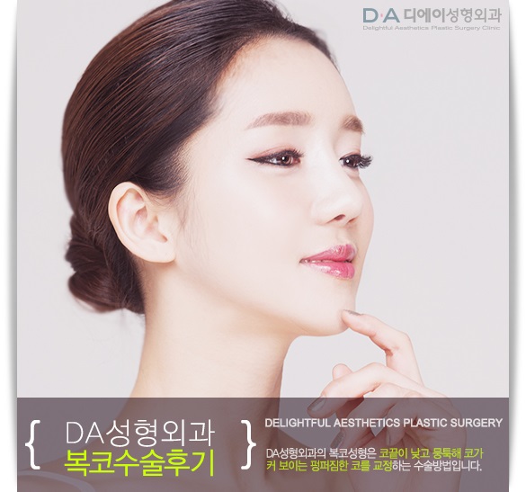 펑퍼짐한 코의 변신 DA성형외과에서 복코수술로 해결해요 관련 이미지 3