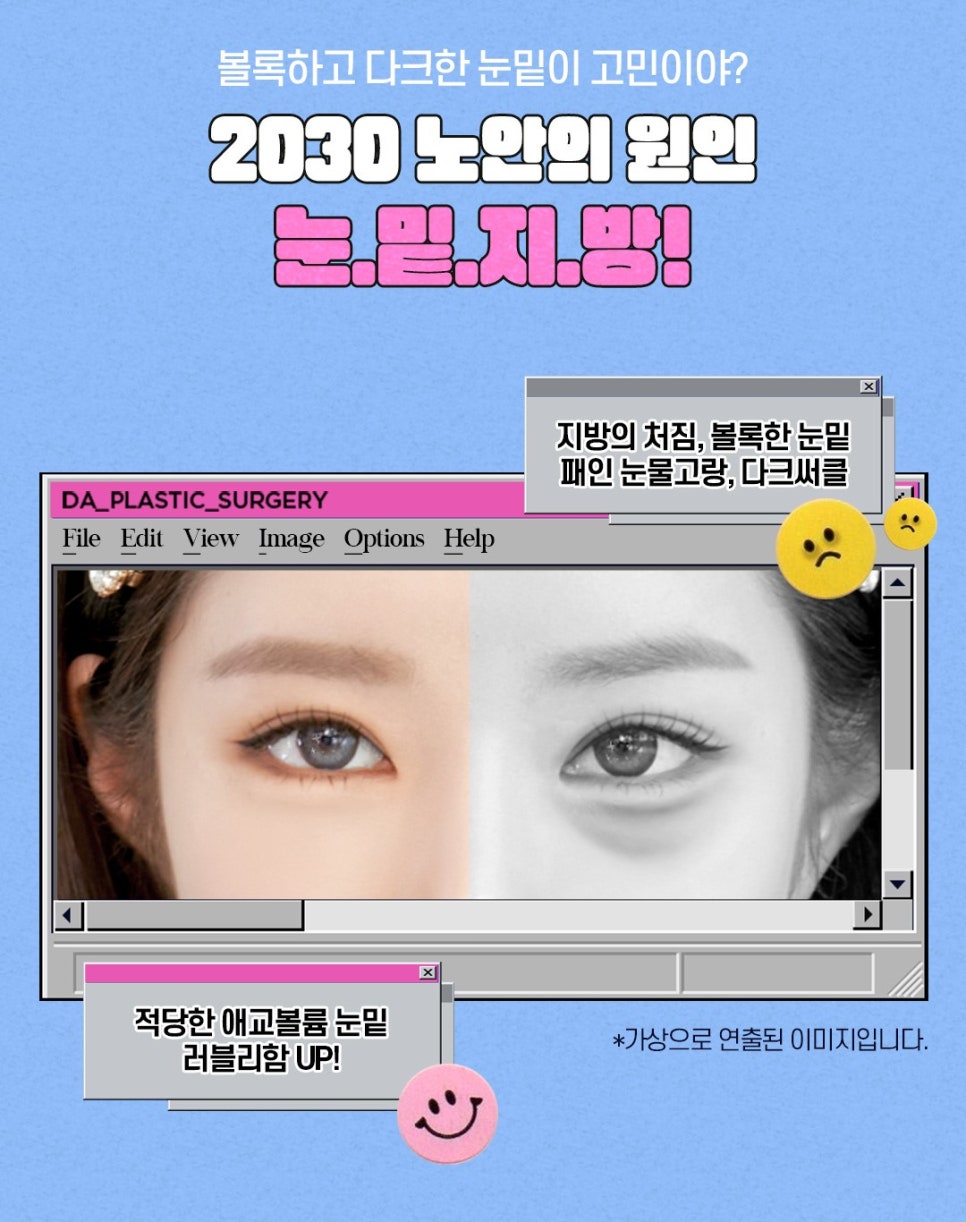 강남역 눈밑지방재배치 잘 하고 합리적인 곳은? 관련 이미지 1
