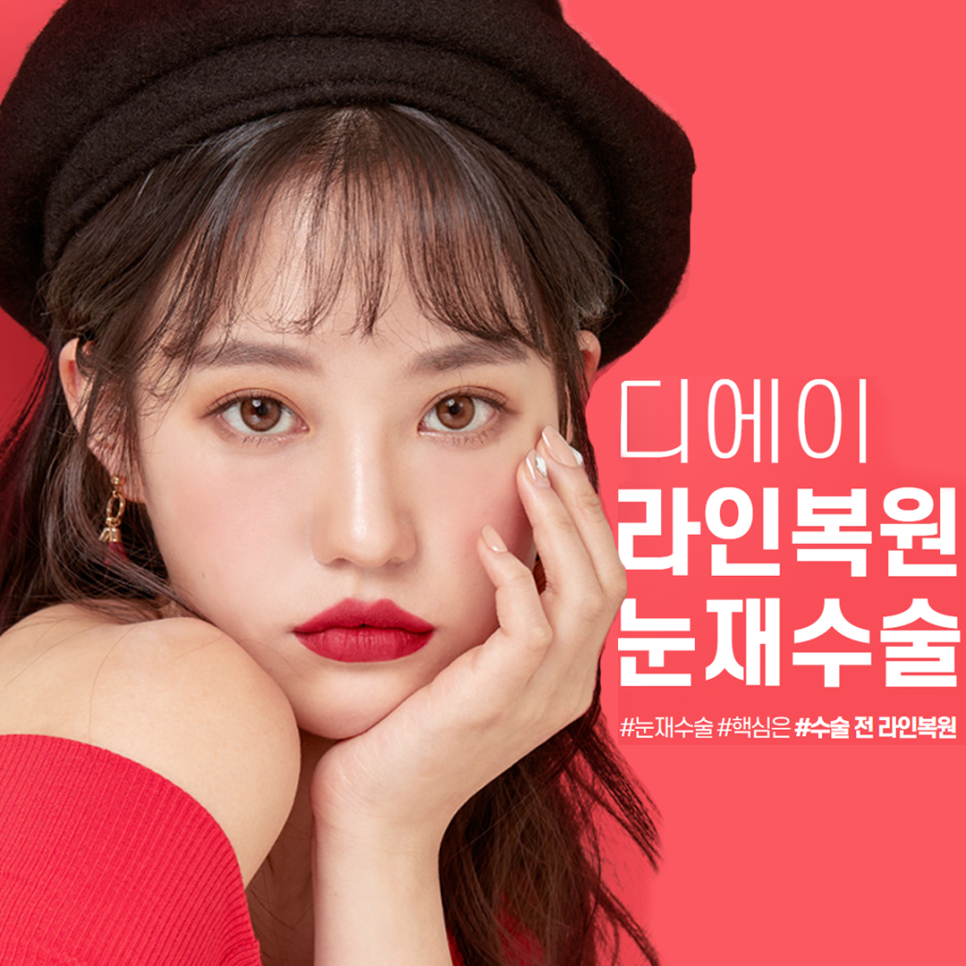 강남역 눈재수술 잘 하는 곳 관련 이미지 1