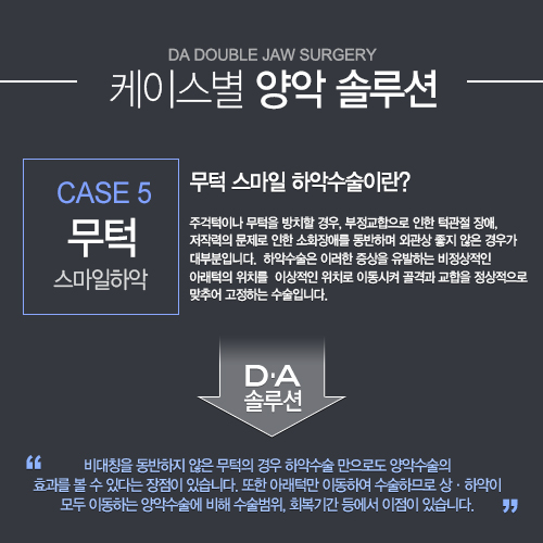 [DA성형외과 스마일양악수술]케이스별 양악솔루션을 소개합니다. 관련 이미지 5