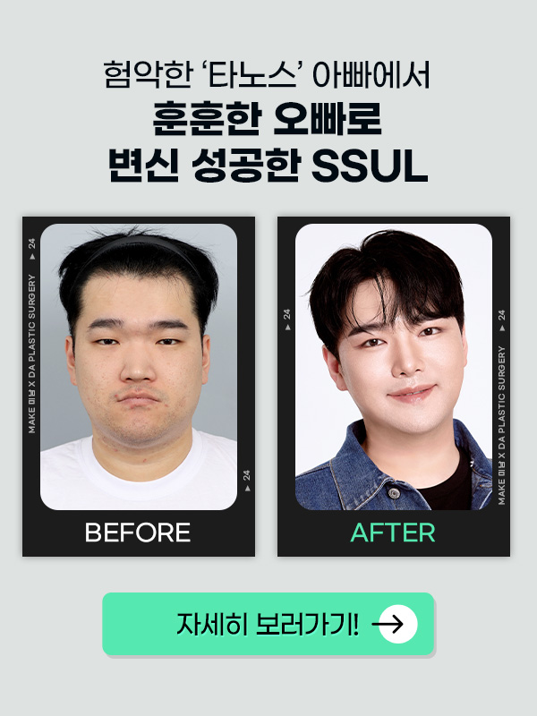 맥미남 make미남 메이크미남 - 디에이성형외과 의벤져스출연 - 7화 야수내남자 관련 이미지 7