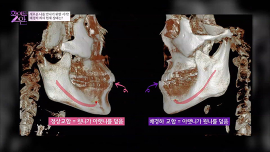 [DA성형외과] 화이트스완 5회 메이크오버 주인공 배경하 관련 이미지 13