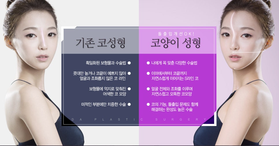 코양이성형으로 얼굴밸런스를 맞추다! 관련 이미지 5