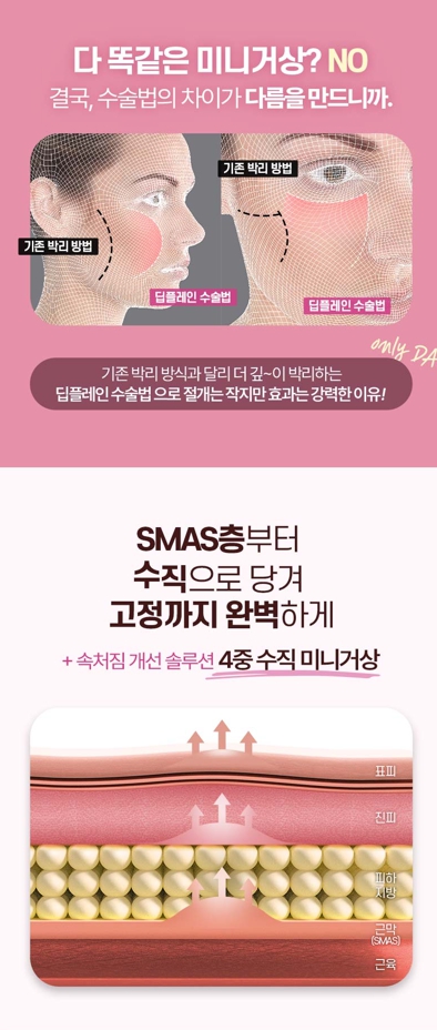수직미니거상, 자연스러운 리프팅을 원한다면 알아볼 점 관련 이미지 7
