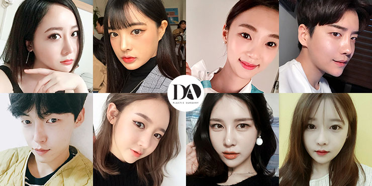 광대 작아지는 법, 광대재위치술이 필요한 유형 관련 이미지 2