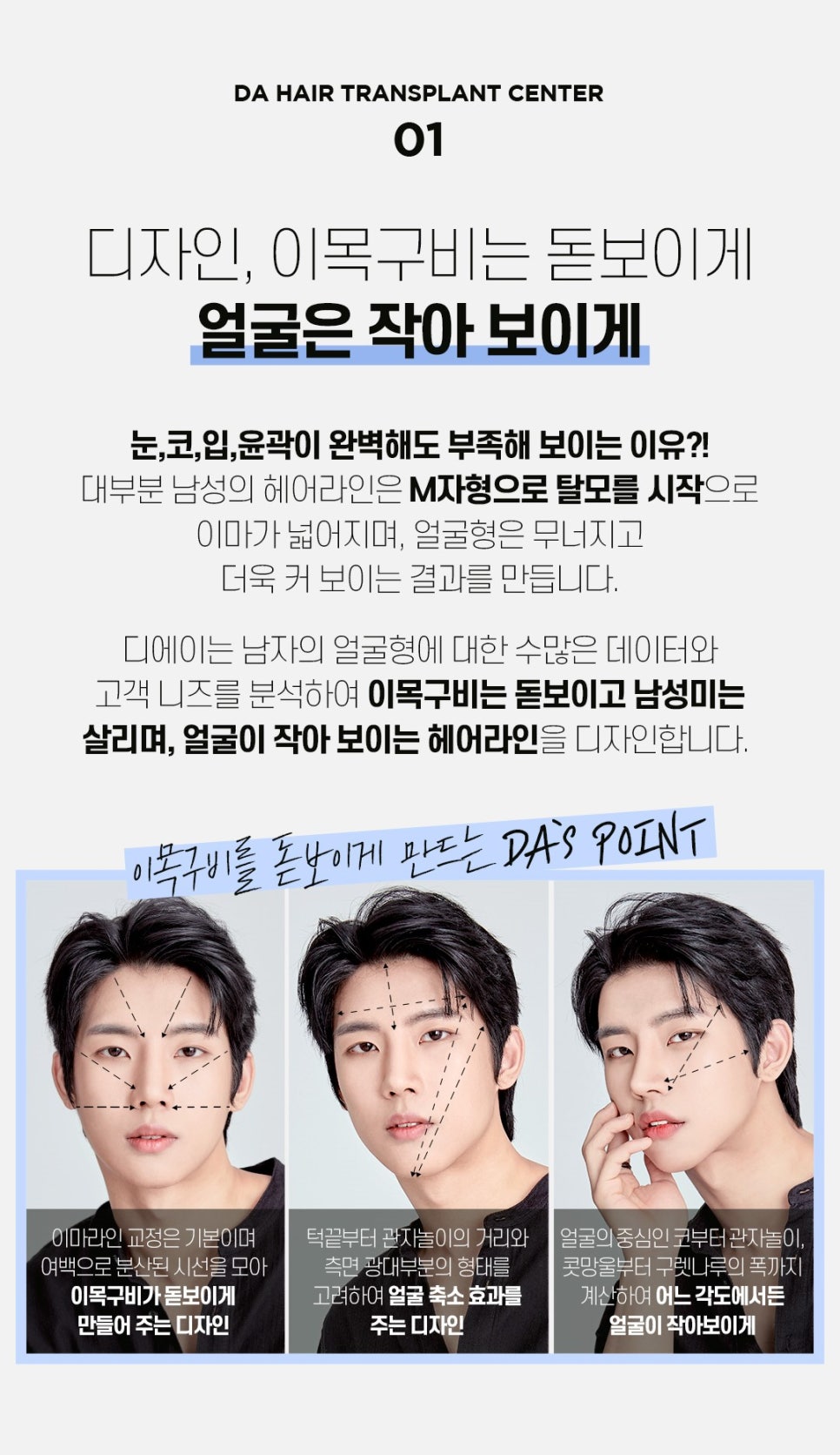 남자 헤어라인 모발이식 후기 비용 궁금하다면 관련 이미지 3