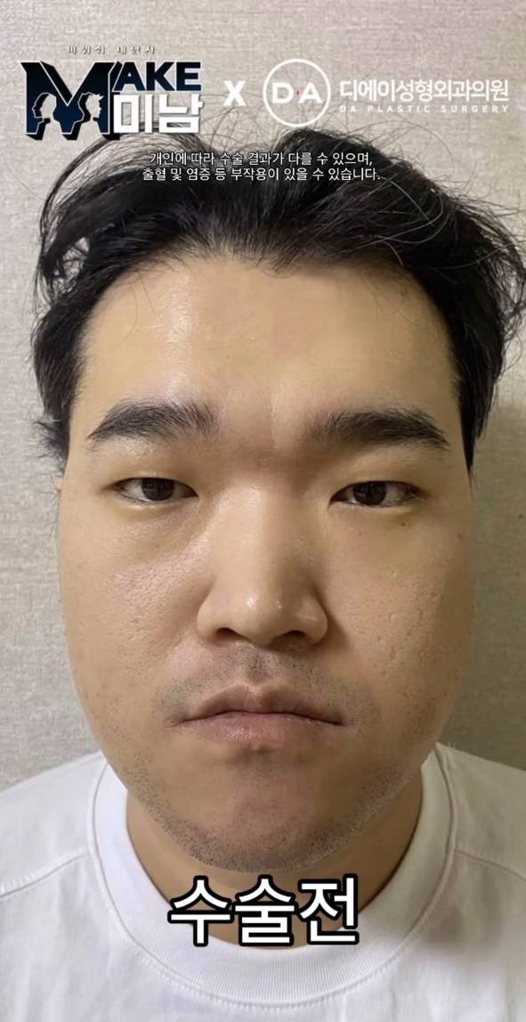 맥미남(MAKE미남) 디에이성형외과 의벤져스 출연 관련 이미지 1