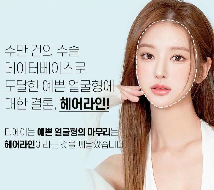 헤어라인 모발이식으로 인형외모갖기 관련 이미지 1