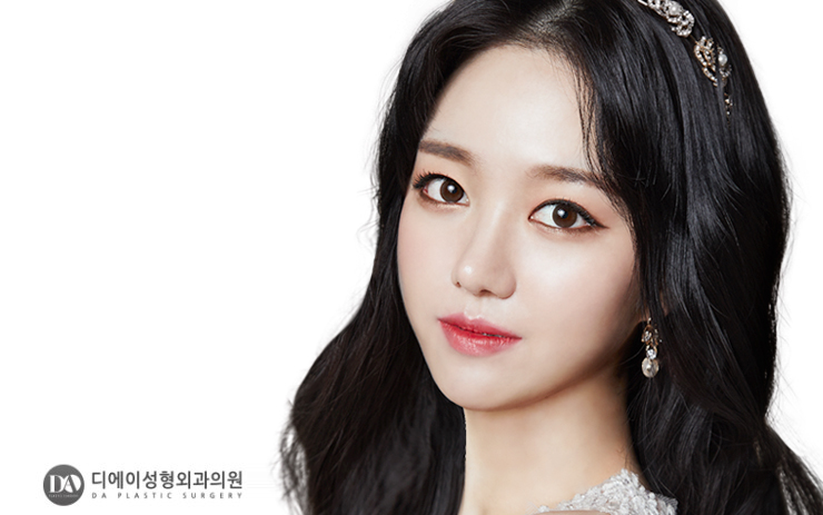 양악수술, 유형별 솔루션 바로 알기 관련 이미지 4