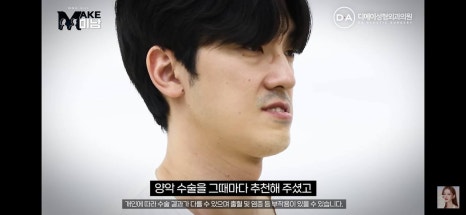 디에이성형외과 | 맥미남 시한폭탄내남자 개인인터뷰 근황 느낀점 관련 이미지 6