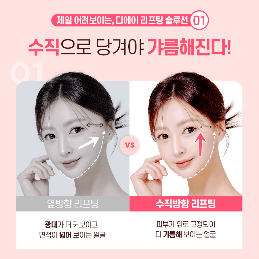 처진얼굴, 탄력개선에 효과적인 시술 방법 관련 이미지 5