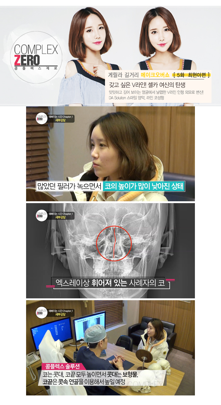 디에이성형외과 콤플렉스제로 5대 제로女 최현아편! 관련 이미지 6
